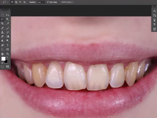 Δείτε πως να κάνετε λεύκανση δοντιών στο Adobe Photoshop