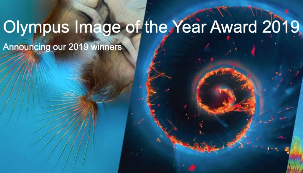 Olympus Image of the Year Award 2019: Αυτοί είναι οι νικητές με τις εντυπωσιακές εικόνες από μικροσκόπιο!