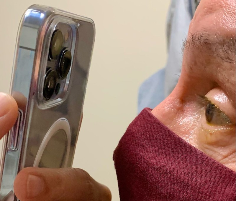 Γιατί ένας οφθαλμίατρος χρησιμοποιεί το iPhone 13 Pro για να φωτογραφίζει τα μάτια των ασθενών του;