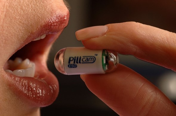 PillCam: Περισσότεροι από 2.000 ασθενείς κατάπιαν αυτή την μικροσκοπική κάμερα αντί να κάνουν κολονοσκόπηση