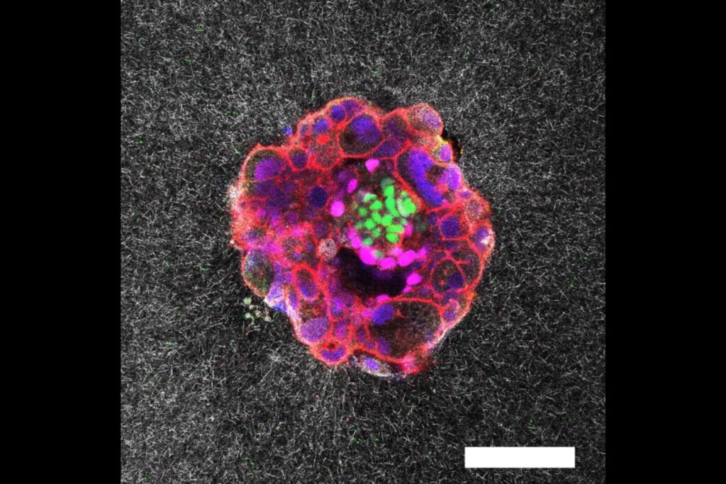 Για πρώτη φορά επιστήμονες κατέγραψαν την εμφύτευση ανθρώπινου εμβρύου σε πραγματικό χρόνο