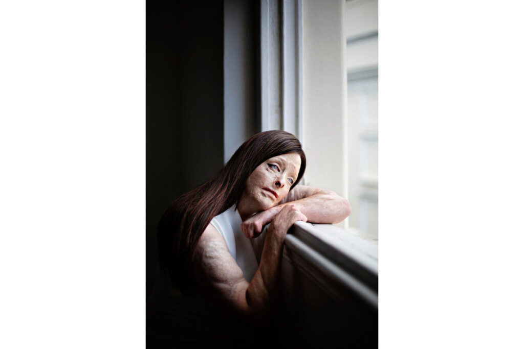 Το Taylor Wessing Photo Portrait Prize 2025 αναδεικνύει τη Martina Holmberg ως νικήτρια