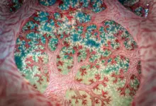 Νικητήριο έργο του Close-Up Photographer of the Year 7 με υποβρύχια φωτογραφία μέσα σε κοράλλι