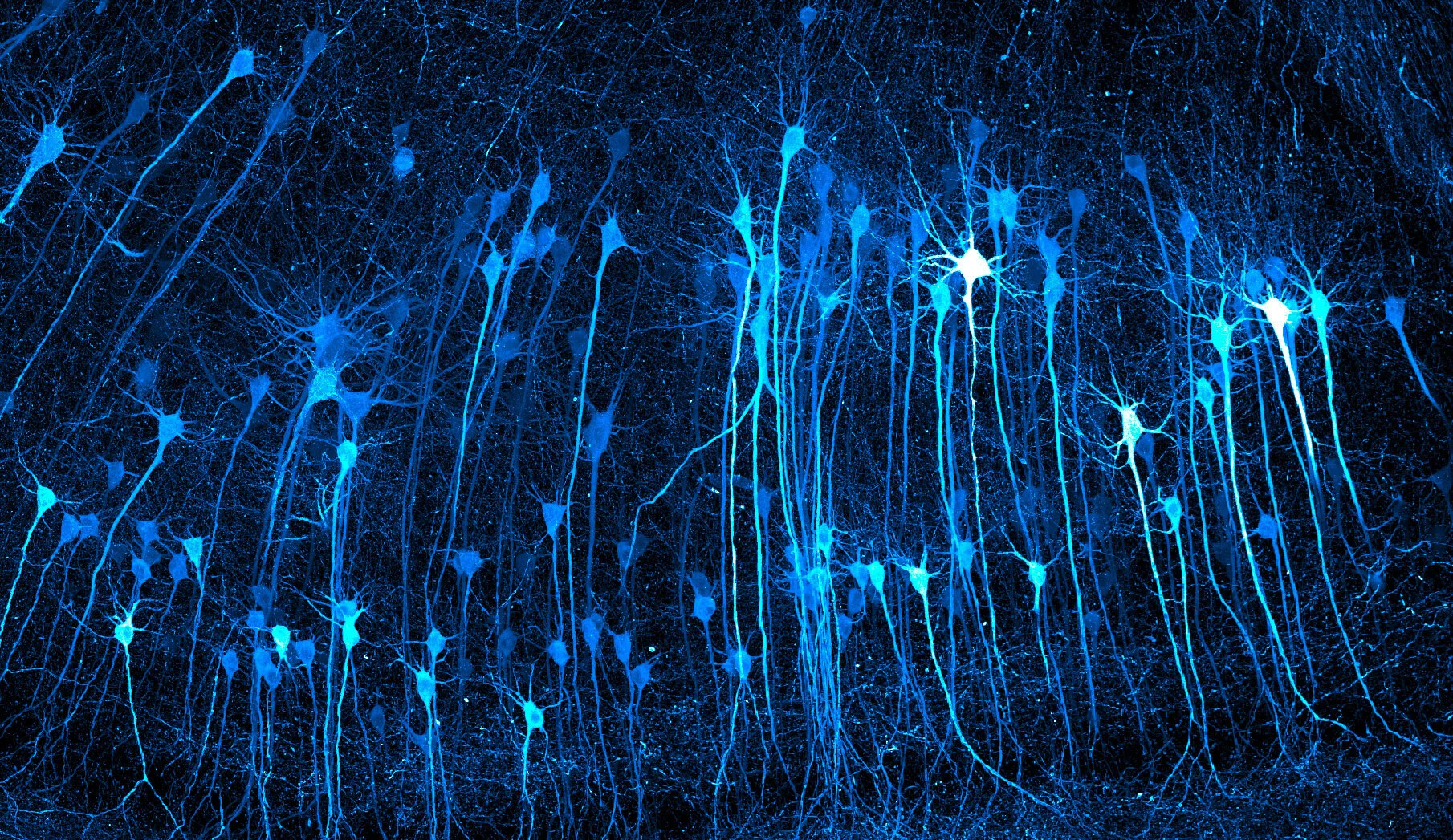 Neurons in an expanded mouse brain