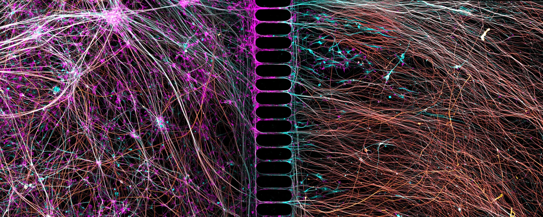 Human neurons reprogrammed from skin cells in a microfluidic chamber