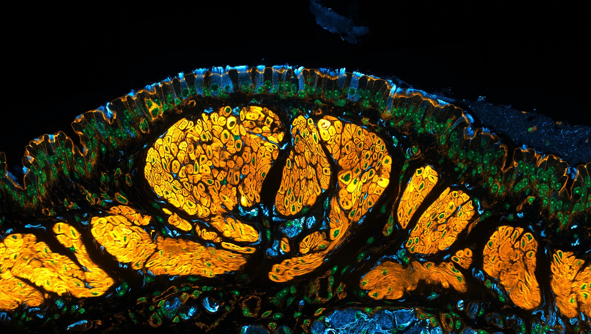 Mouse trachea with ciliated cells and nerve fibers