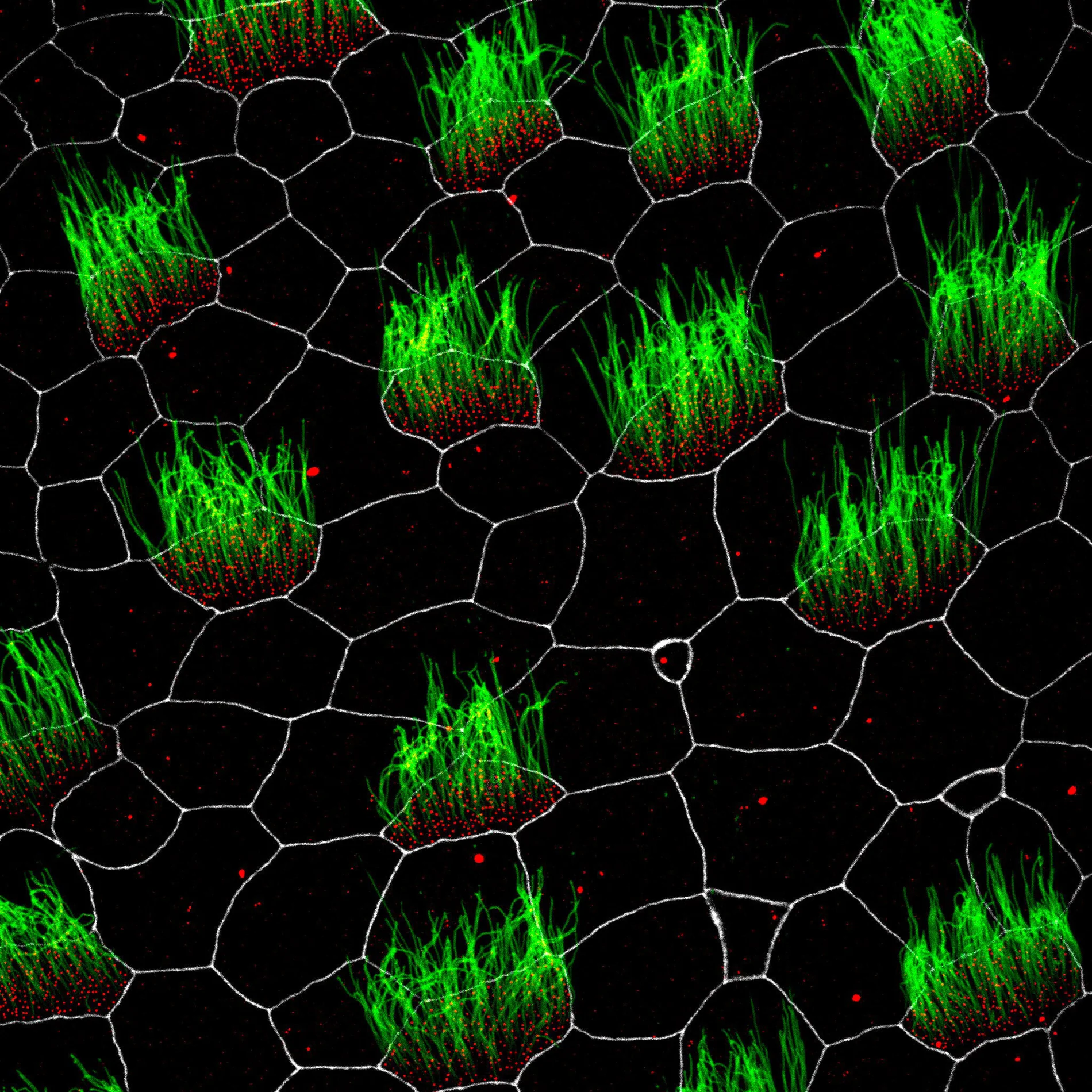 Embryonic Xenopus skin cells showing cilia, centrioles and membranes