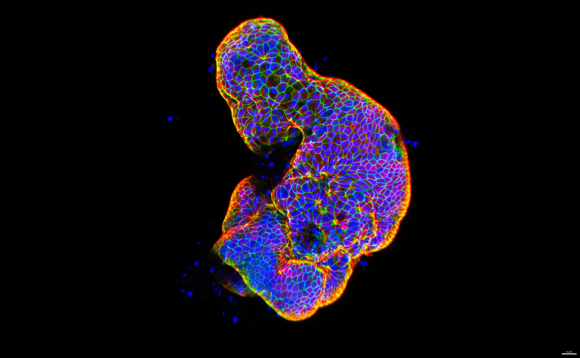 Lab-grown human intestinal tissue