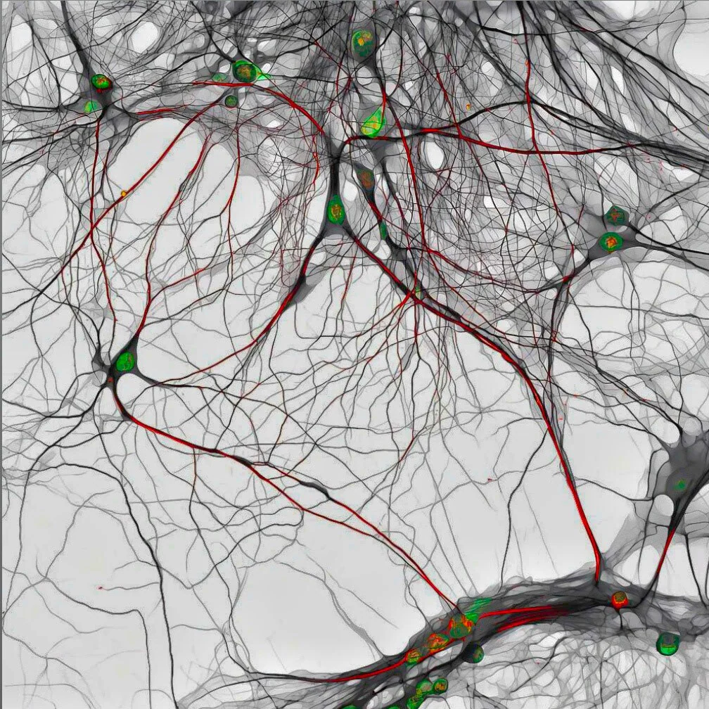 14-day-old mouse hippocampal neurons