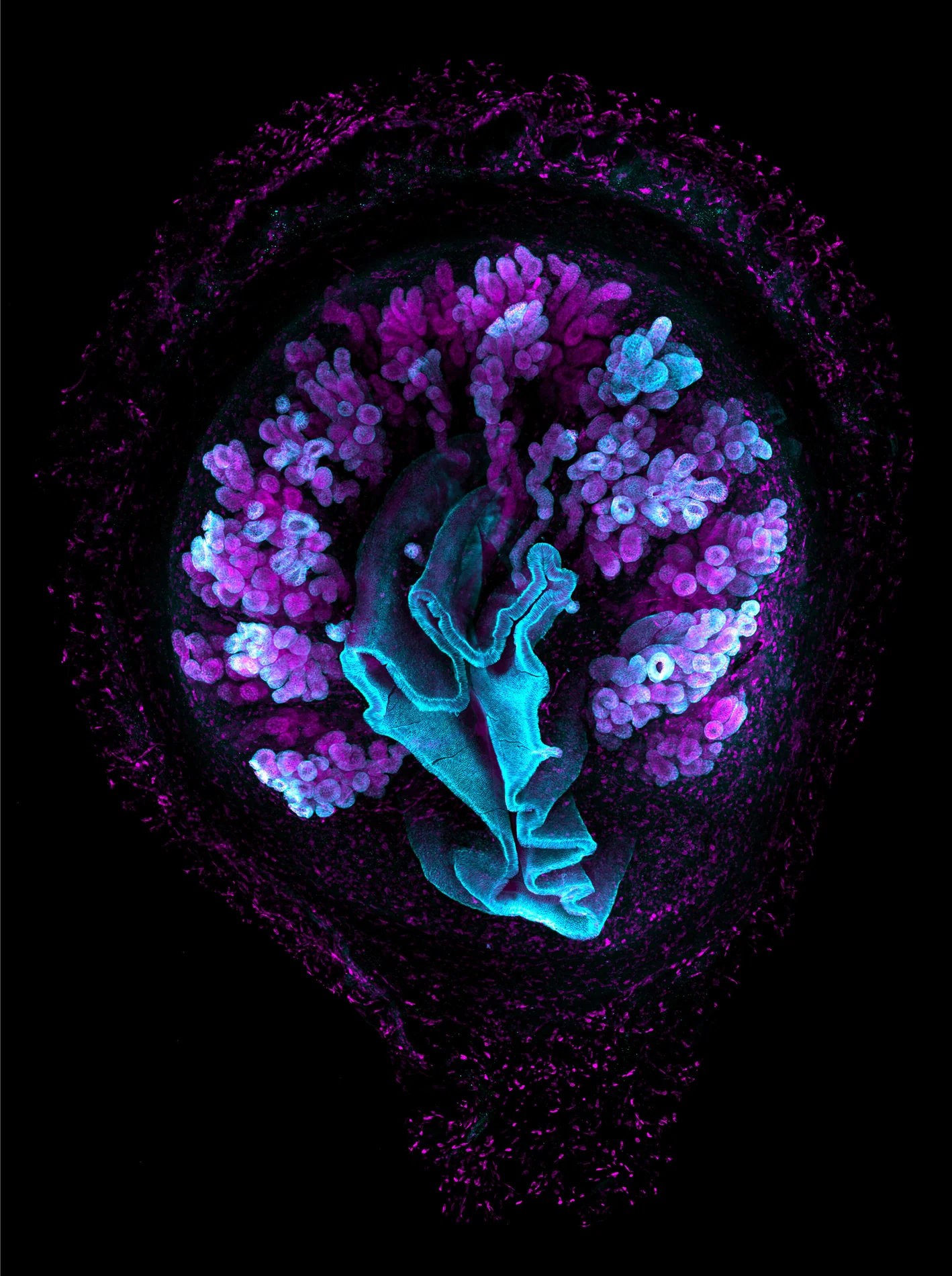 Mouse uterus with epithelial gland structures