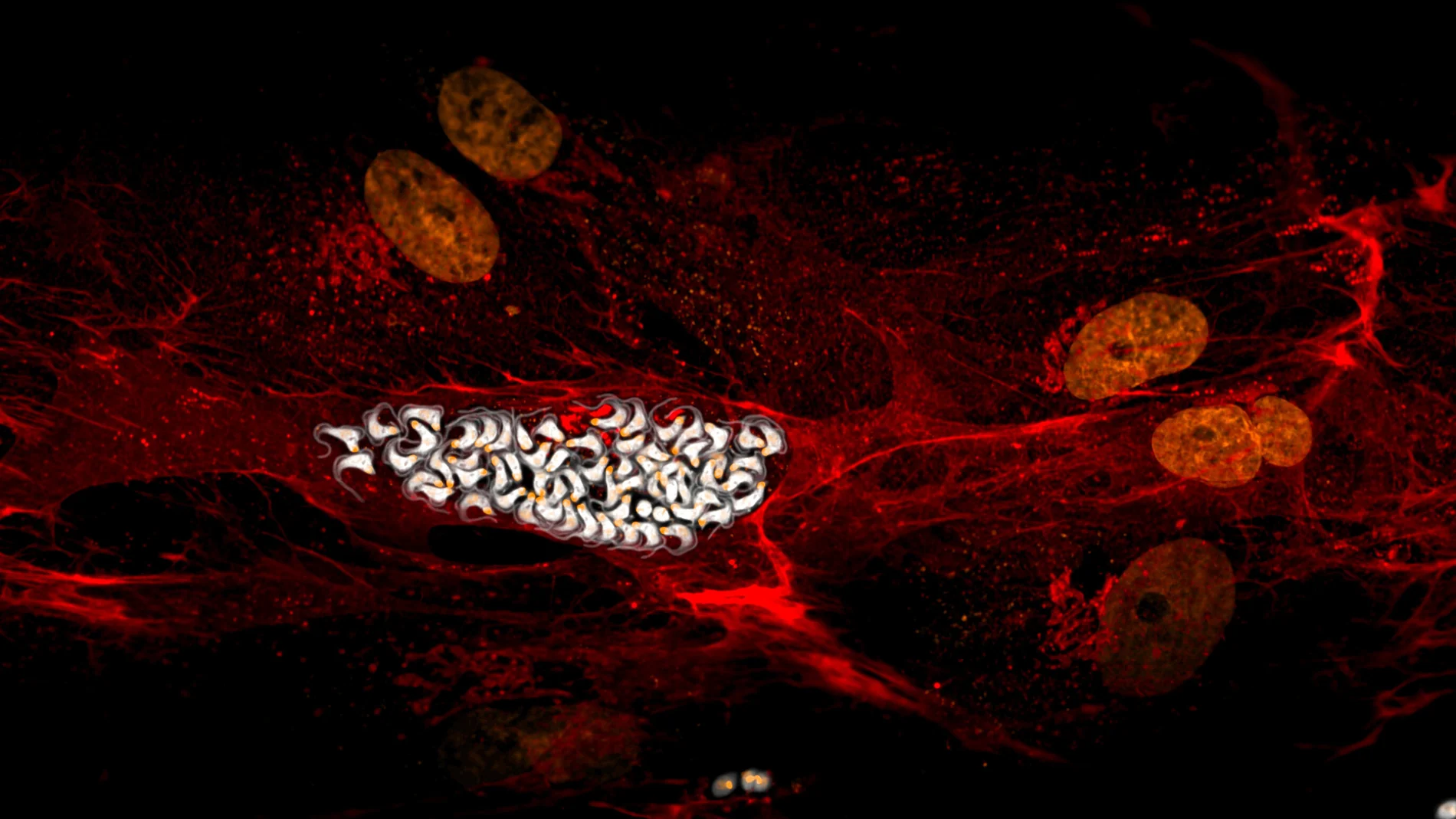 Trypanosoma cruzi parasites inside human fibroblasts