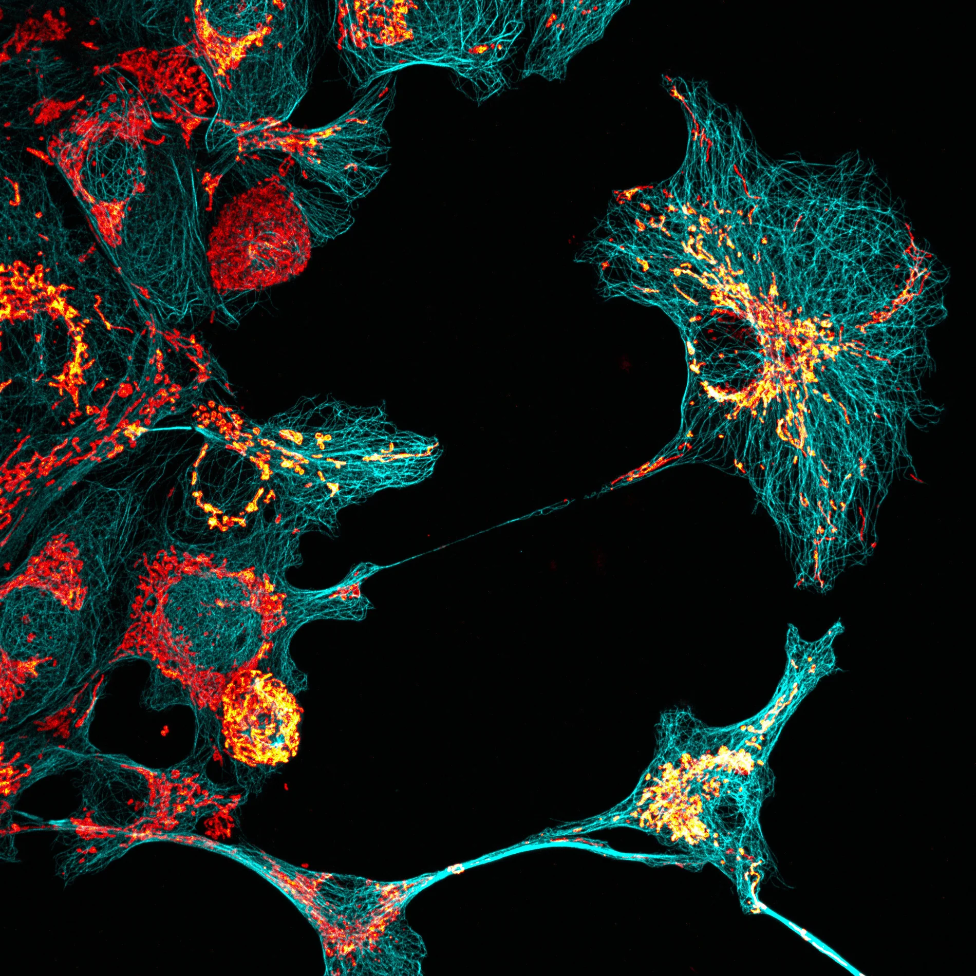 African green monkey kidney cells with microtubules and mitochondria